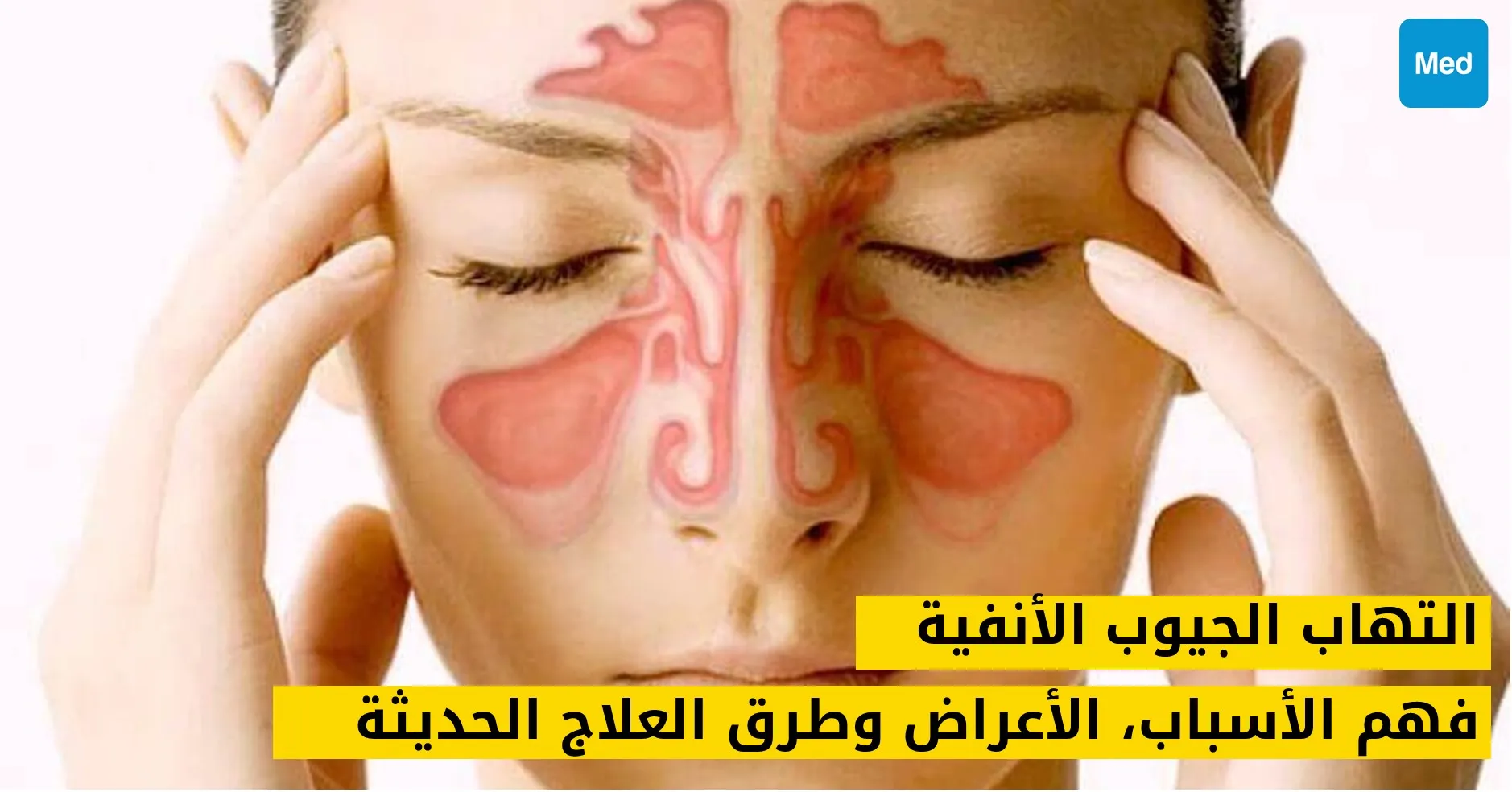 التهاب الجيوب الأنفية: فهم الأسباب، الأعراض وطرق العلاج الحديثة